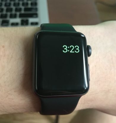 My Apple Watch Only Shows The Time! Here's The Real Fix.